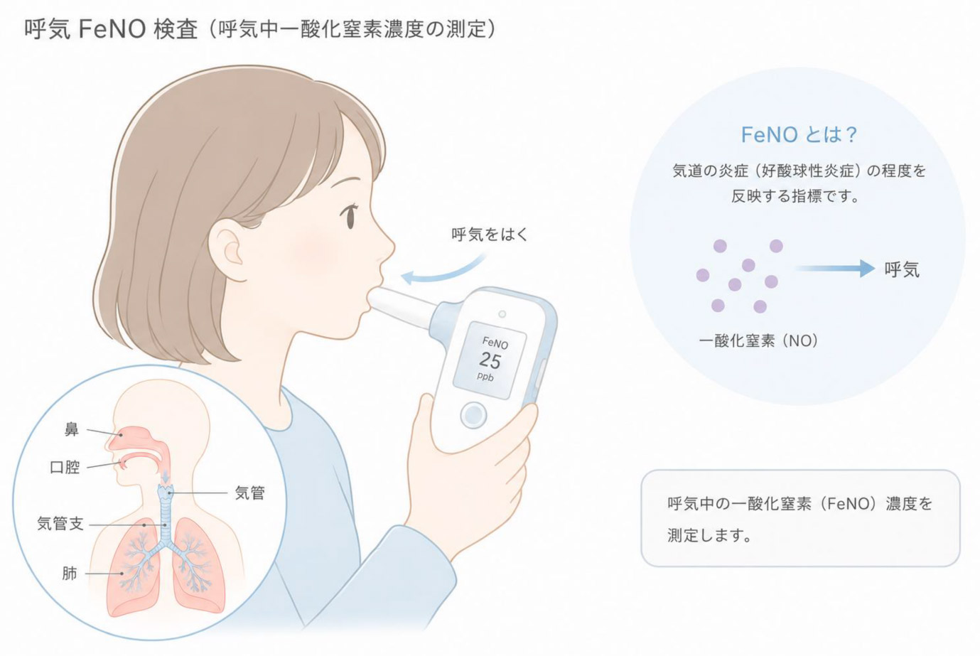呼気NO（FeNO）検査